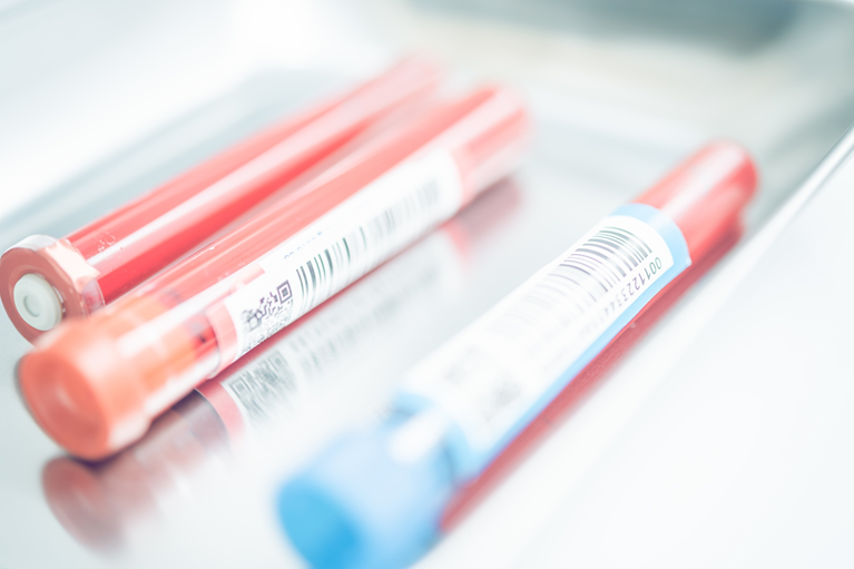 貧血の検査方法